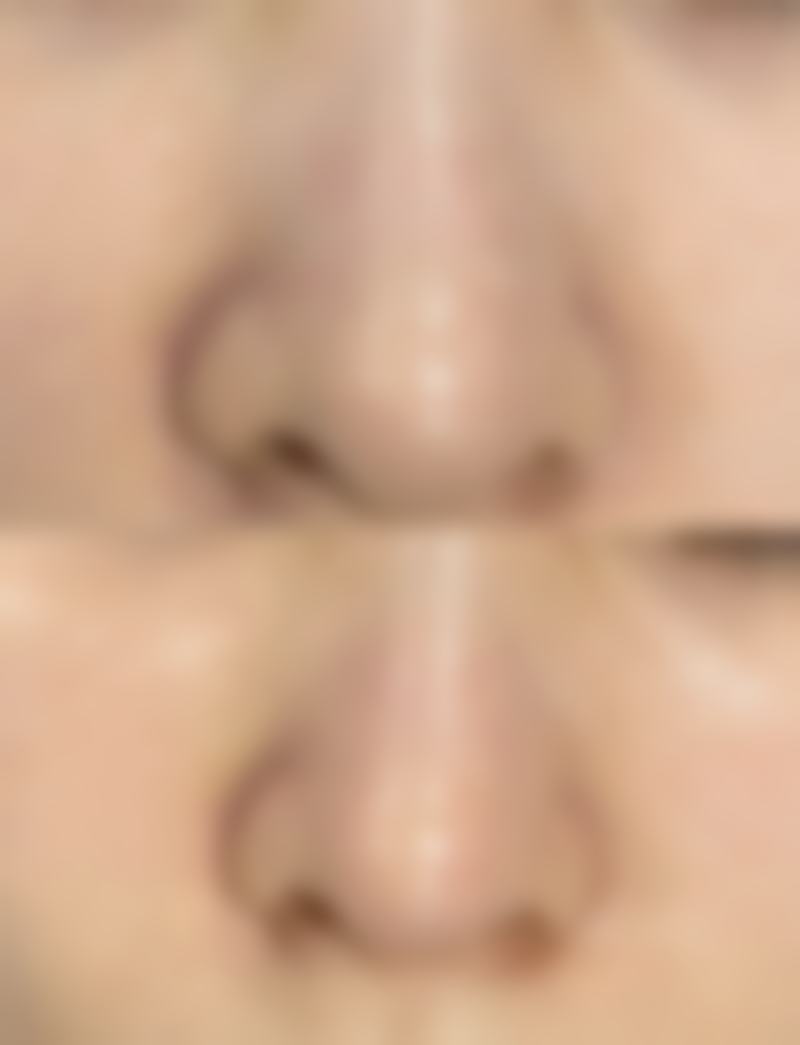 【昭通朝阳医院皮肤美容科诊疗设备：】