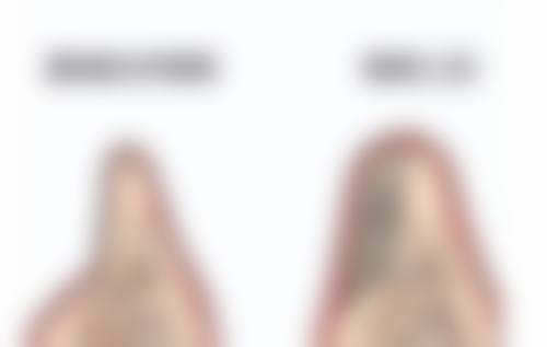 五、打除皱针的价格
