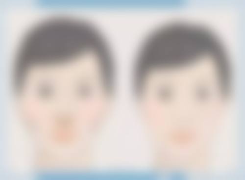 瘦脸针多少钱打一针