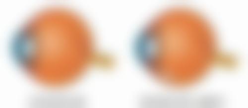 瘦脸针打几次就恒久了