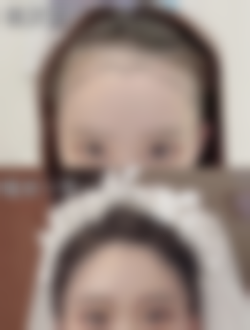 填充下巴后有硬疙瘩怎么办