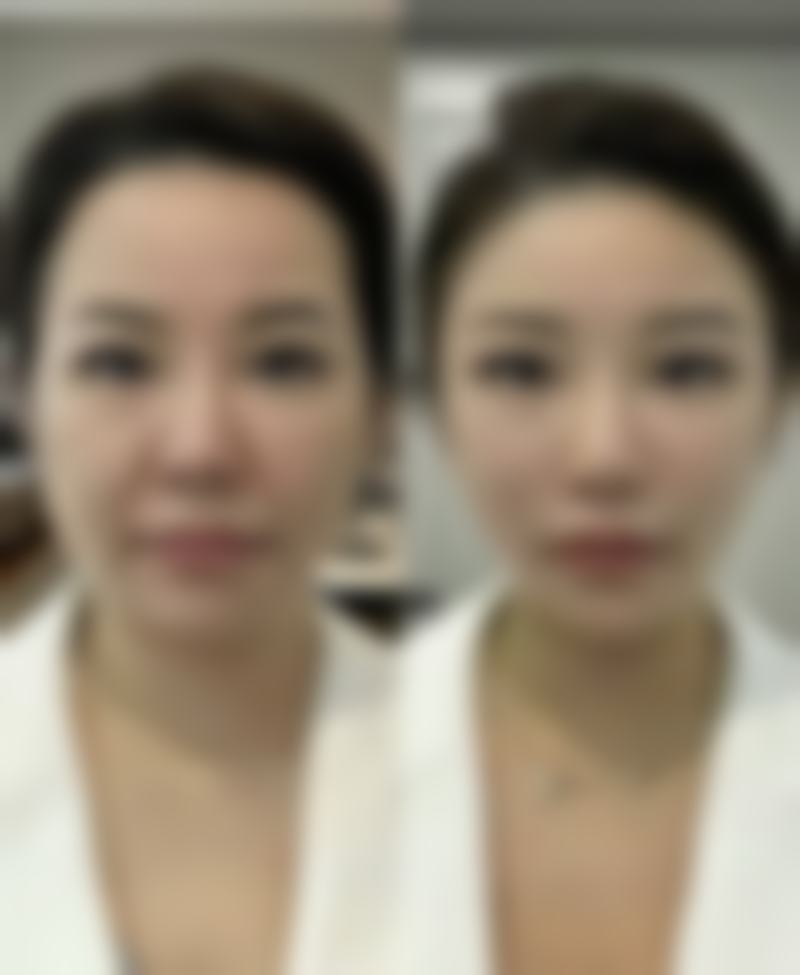 虽然资料中未提及具体医生名字,但可以知道诊所拥有一大批优质专精人员,他们精通几十项医疗美容技术,在整形手术、皮肤美容、注射美容等多个领域都有着丰富的经验。这些专精人员凭借自己的专精技能,为患者提供高质量的美容服务。