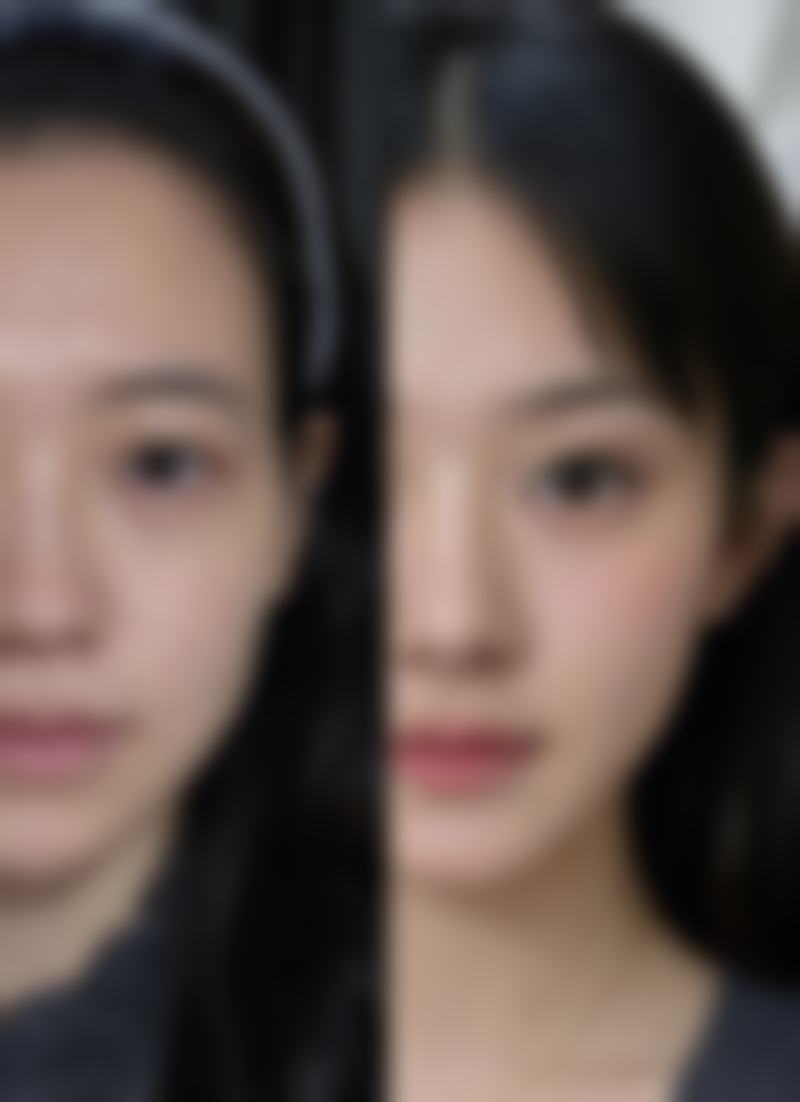 瘦脸针多久打一次成效至佳