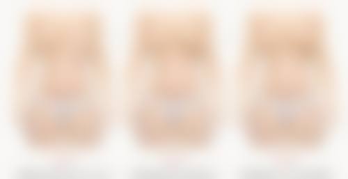 面部除皱手术效果如何？术后肌肤年轻10岁、持久紧致，抗衰达人亲测有效！