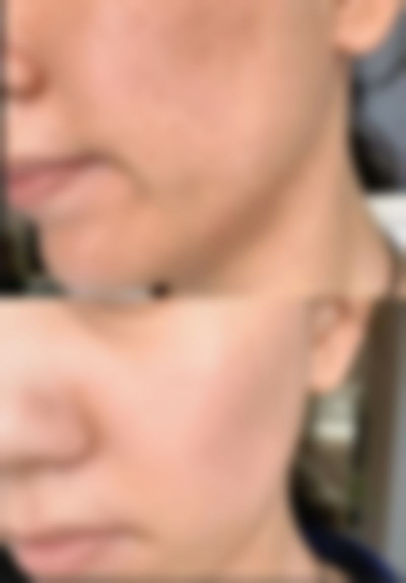 整容可以整全脸吗
