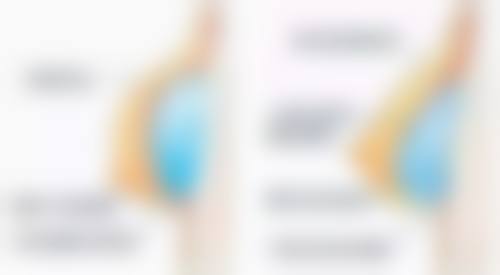 打瘦脸针的注意事项