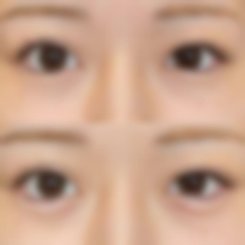 【眉县赫丽森医疗美容诊所怎么预约挂号?】