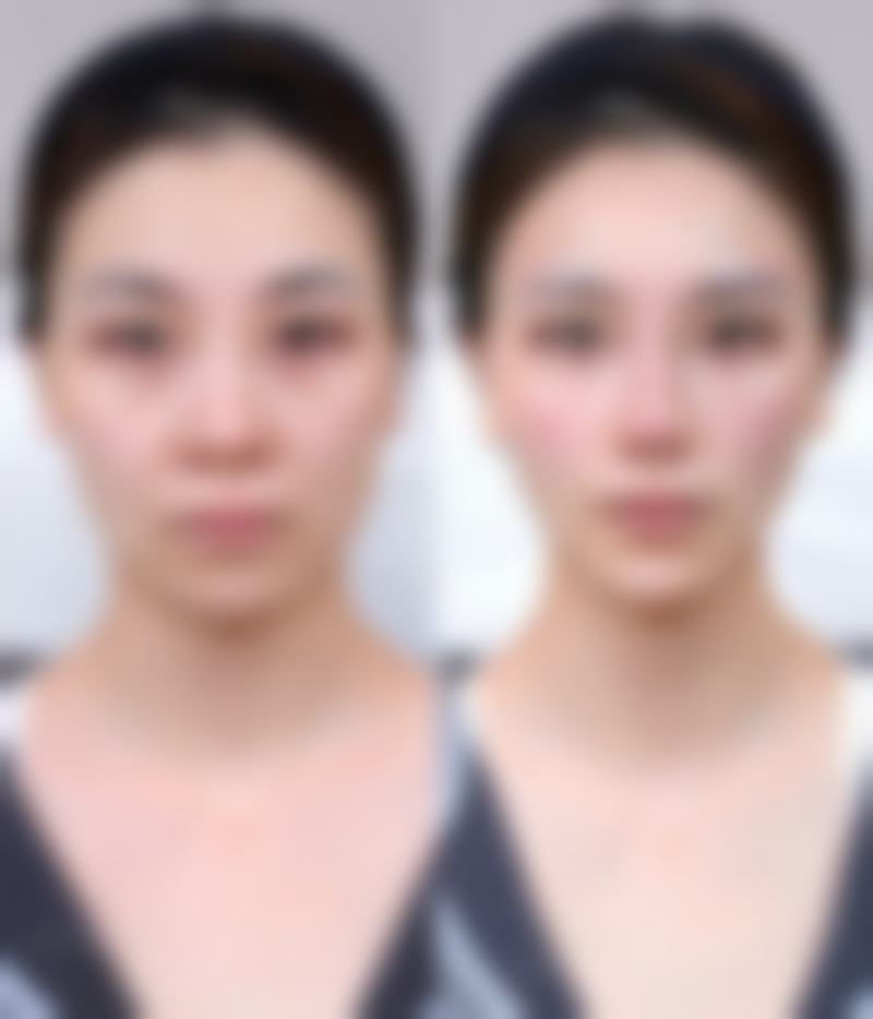 【青岛长江医院特色项目：】