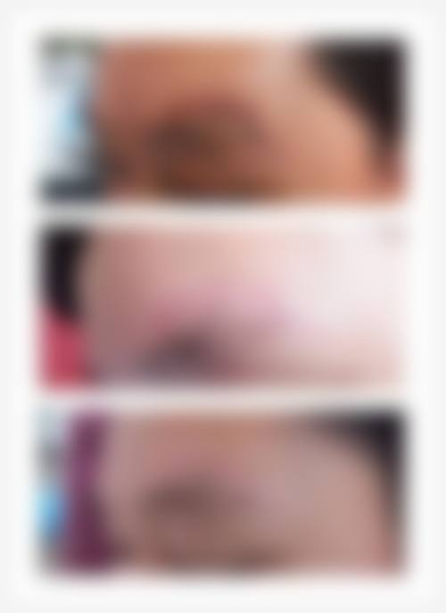 【湘潭星美慈整形医疗美容患者口碑评价:】