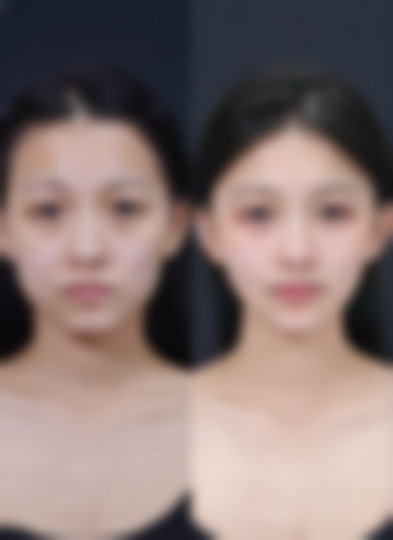 阴道紧缩术对人体有害吗？揭秘3大真相，看它如何安全提升女性生活质量，重拾私密健康自信！ 