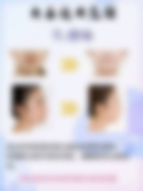 进口瘦脸针的副作用