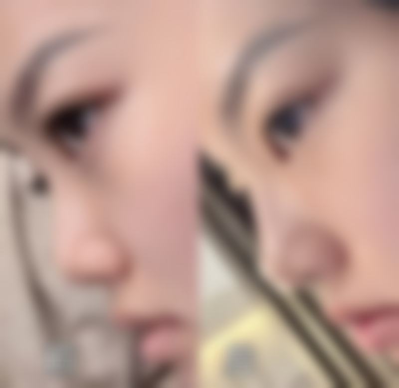 【西安艺美医疗美容诊疗设备：】
