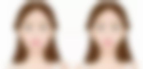 方脸的人打瘦脸针有成效吗