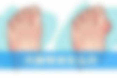 全脸打除皱针有没有什么伤害？权威解析告诉你，掌握这些要点可将风险降至 99%，安心变美不是梦！ 