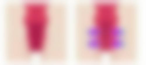 嘴唇怎么整形好看？掌握这5种热门医美方法，让你轻松拥有迷人嘟嘟唇！ 