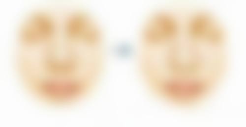 进口瘦脸针和国产瘦脸针的区别