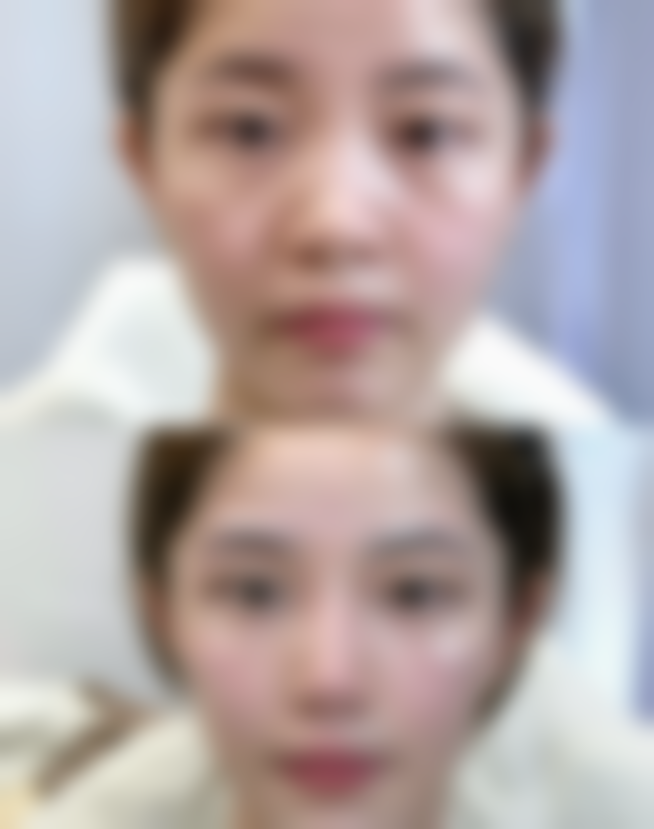 嘴唇怎么整形好看女生