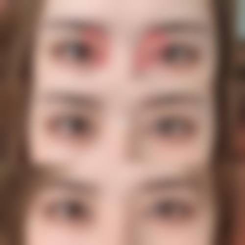 【于海波医生技术特点】