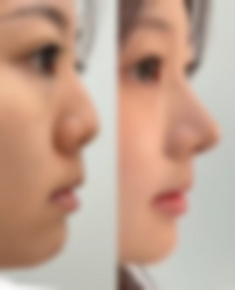 【徐州新沂艾美医疗美容门诊部特色项目:】