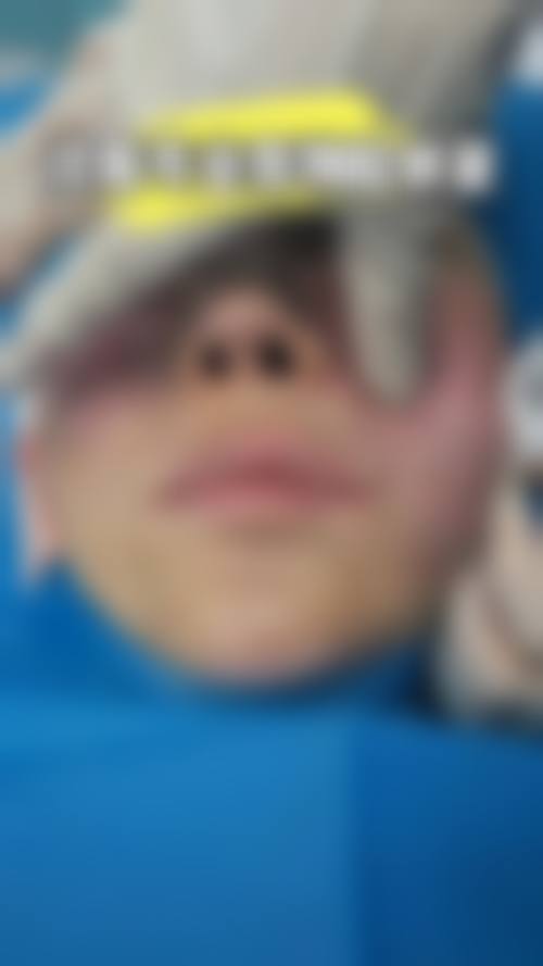 【石家庄壹零壹华擎医疗美容医院特色项目：】