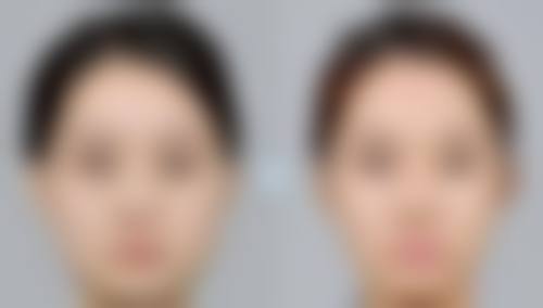 嘟嘟唇适合嘴唇薄的人吗