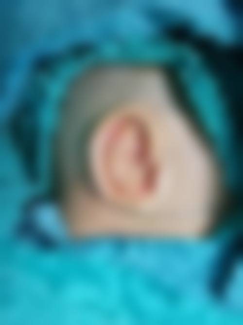 【深圳臻艺医疗美容皮肤诊所特色项目:】