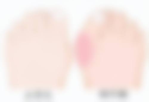 如何合理利用瘦脸针