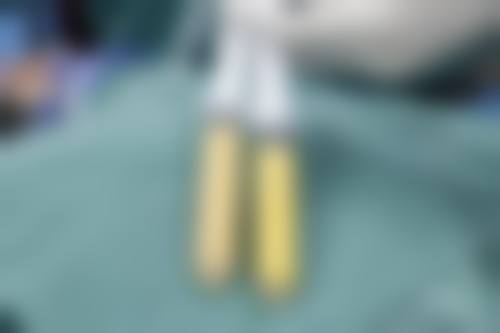 【郭宝锋医生口碑怎么样?】
