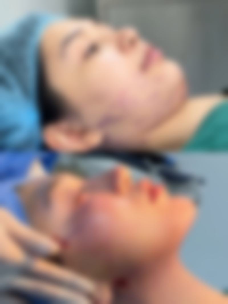 不同类型的毛发种植