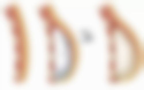 瘦脸针打几次就恒久了