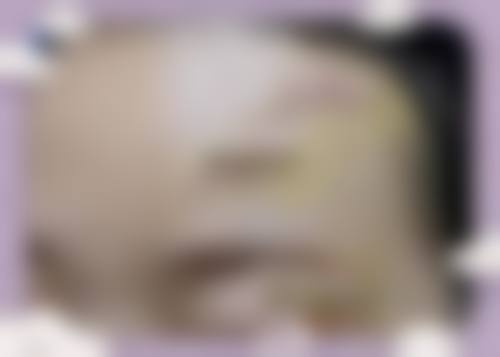 【辽源新华整形医院患者口碑评价:】