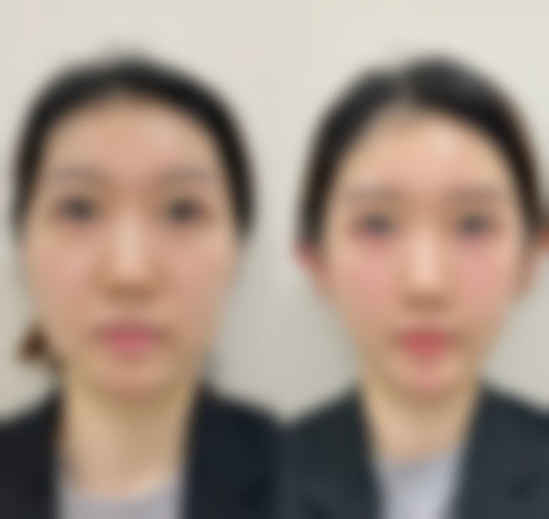 【驻马店丽人美容医院整形科患者口碑评价:】
