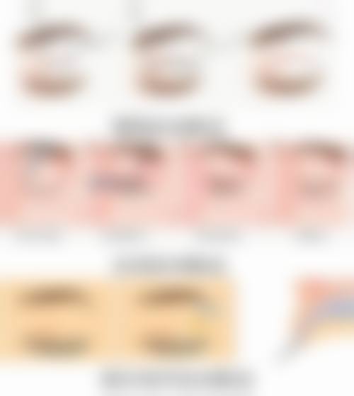 打完绿毒瘦脸针多久可以怀孕