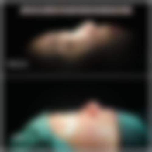 【佛山小天使美容医院参考价格表：】