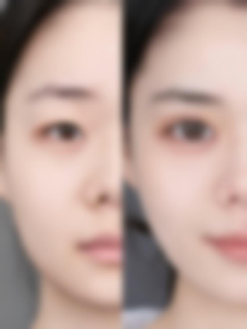 【深圳瑞斯医疗美容门诊部参考价格表：】