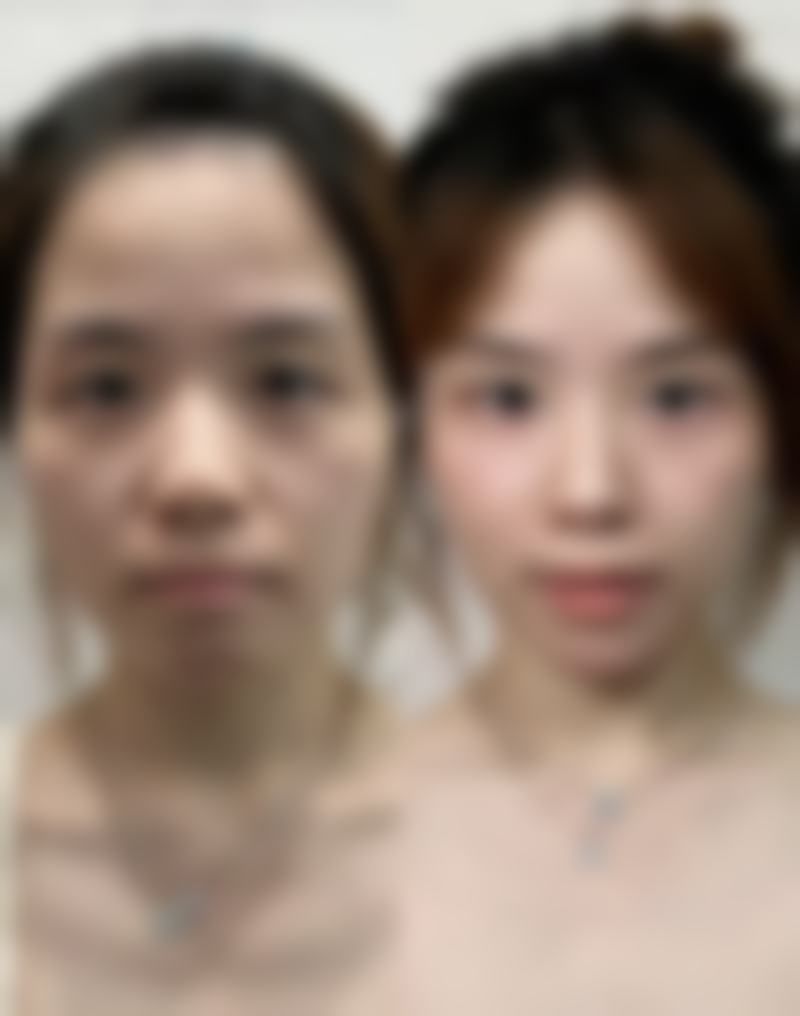 【北京首大眼耳鼻喉医院怎么预约挂号?】