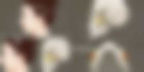 丰太阳穴用什么好？玻尿酸、自体脂肪哪个更适合你？看完这篇热门医美攻略就懂了！ 