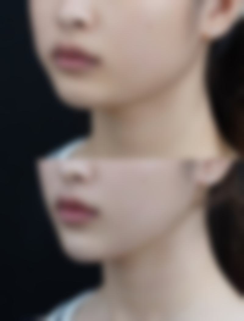 【心美眼整形外科特色项目：】