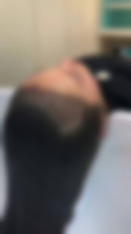【张绍医生技术特点】