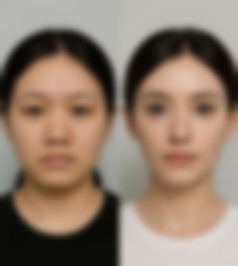 当然是正规的啦!天津英瑞齿科(小白楼店)是经过卫生部门批准的口腔专职机构,这可是有法定认证的呢。就像拿到了一张合法经营的通行证,大家可以放心地在这里进行口腔治疗。卫生部门的批准意味着它在医疗资质、人员配备、设备设施等方面都达到了相应的标准,能够为患者提供安心、有效的口腔医疗服务。