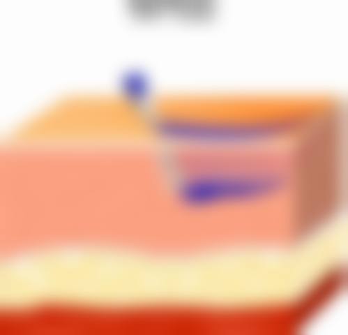 【石楠楠医生怎么预约挂号?】