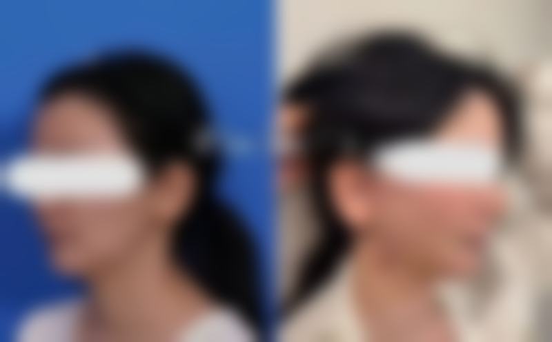 【成都聚美丽人医疗美容门诊部特色项目:】