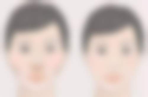 种植毛发价钱是多少呢