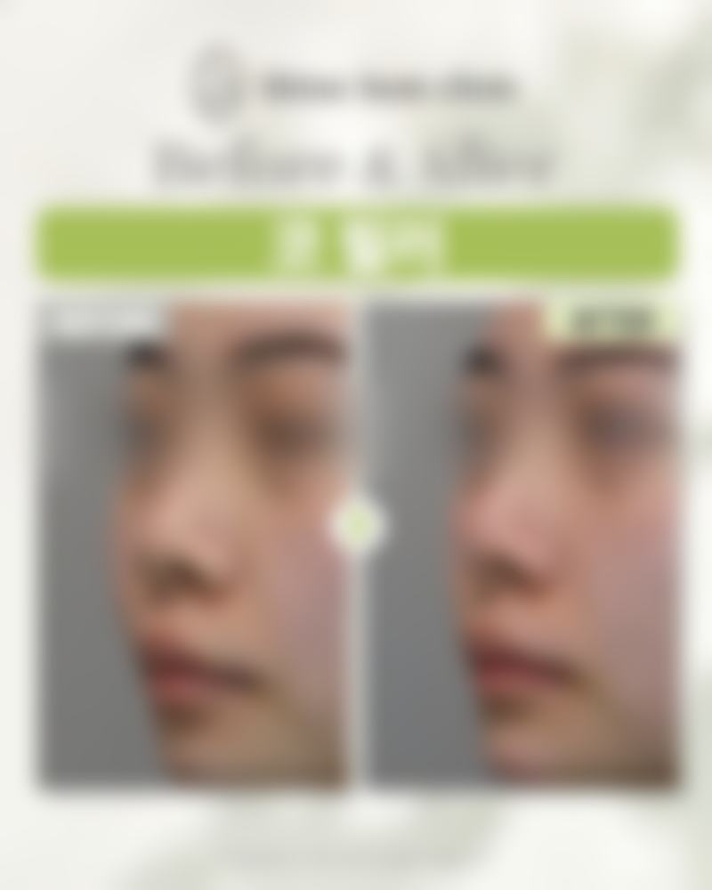 韩国shinebom皮肤科开展该项目的优势