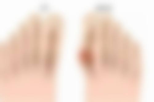 咬肌肥大打瘦脸针会有成效吗