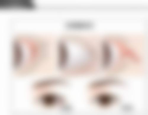 打瘦脸针有没有副作用和后遗症