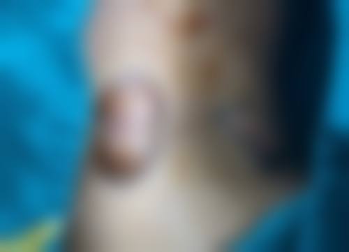 通过整容手术可以改变眼睛的大小吗?
