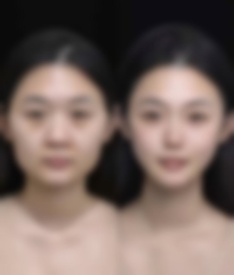 【杨小静医生口碑怎么样?】