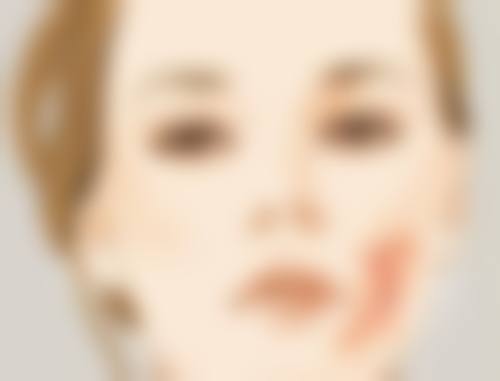衡力瘦脸针打一次能维持多久