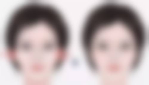 瘦脸针打一次维持多久